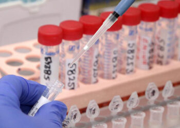 Humbin jetën edhe katër persona nga coronavirusi në Kosovë – konfirmohen 307 raste të reja