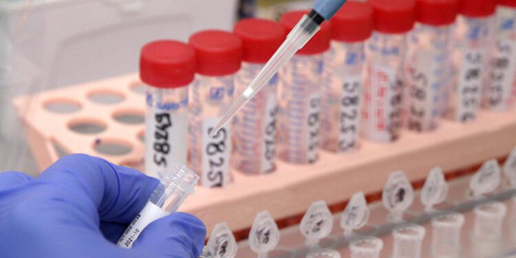 Humbin jetën edhe katër persona nga coronavirusi në Kosovë – konfirmohen 307 raste të reja