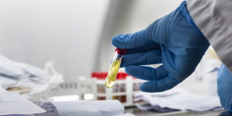 Variantet e reja të COVID-19 të shpjeguara me pak fjalë – cilat janë ato dhe çfarë dihet rreth tyre deri më tani?