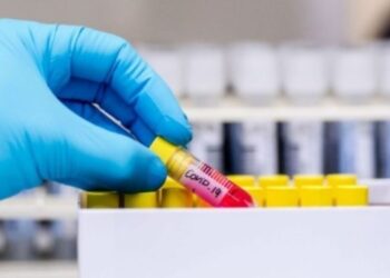 32 të vdekur dhe mbi 1500 raste të reja me COVID-19