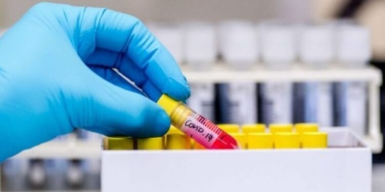 32 të vdekur dhe mbi 1500 raste të reja me COVID-19