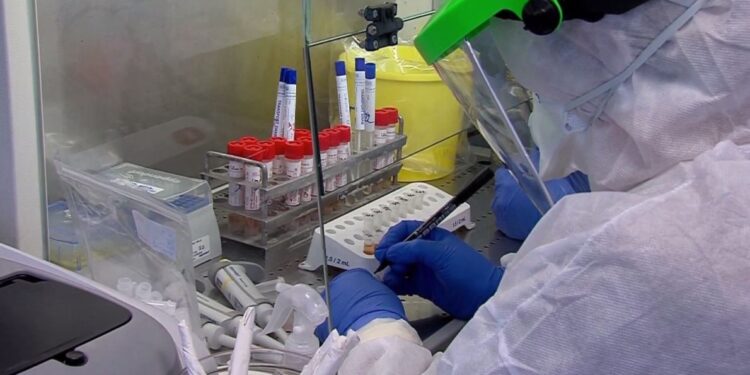 21 vdekje dhe rreth 1 mijë raste të reja me COVID-19 në Maqedoninë Veriore