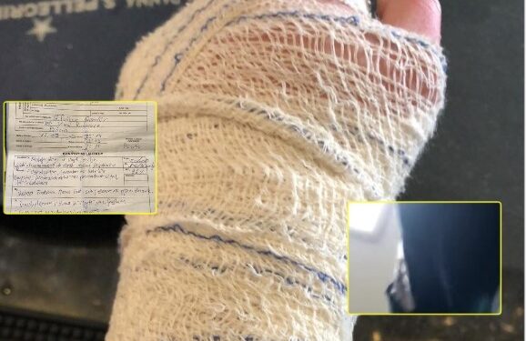 Dhuna e policisë ndaj qytetarëve, i riu nga Prishtina pretendon se Policia ia theu dorën