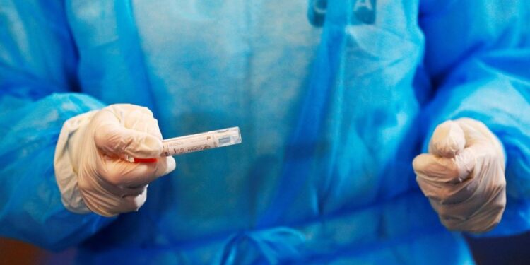 Ramazani ul numrin e testimeve për koronavirus në Kosovë