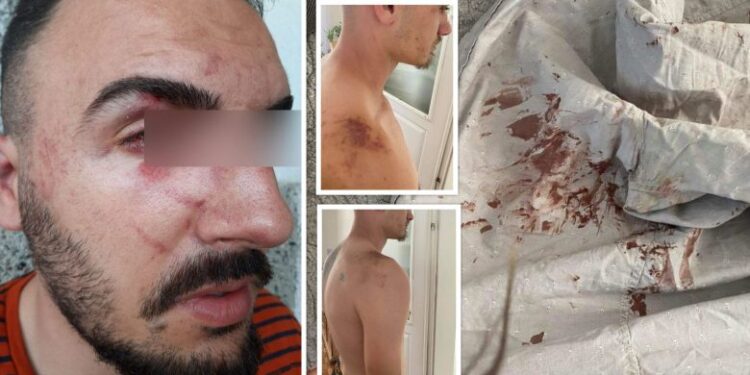 4 të rinj nga Gjilani tregojnë për tmerrin: “I kanë fikur dritat dhe na kanë rrahë deri në alivanosje” (foto)