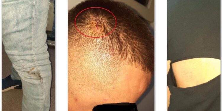 Policit iu ça koka me shishe: Ana tjetër e rrëfimit për rrahjen e 4 të rinjve në Gjilan – FOTO