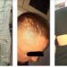 Policit iu ça koka me shishe: Ana tjetër e rrëfimit për rrahjen e 4 të rinjve në Gjilan – FOTO