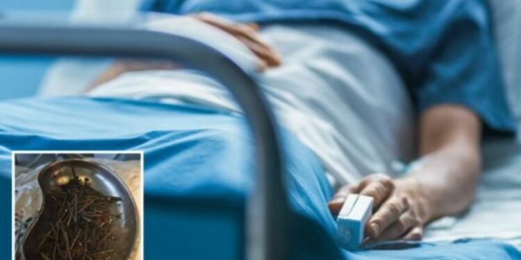 Mjekët ja gjejnë mbi një kilogram gozhda në stomakun e pacientit (foto)