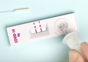 Ja kur duhet të bëni testin PCR dhe kur një test të shpejtë antigjeni