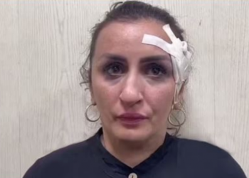 Nëna shet foshnjën e porsalindur për të bërë operacion plastik