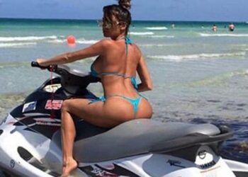 Rregullimi i vitheve i kushtoj më jetë modeles